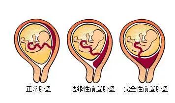 比賽展風采，實戰(zhàn)驗真金
